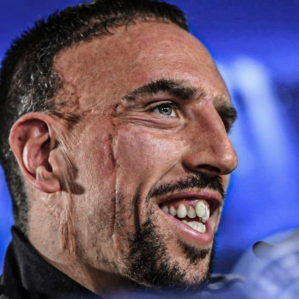 Franck Ribéry Marsaille